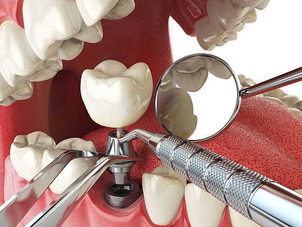Best Emergency Root Canal Treatment in Blanding, UT